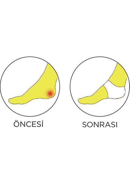 Kuru Topuk Çorabı