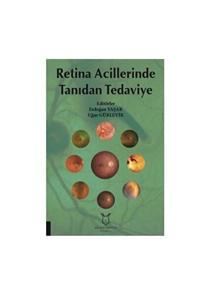 Retina Acillerinde Tanıdan Tedaviye