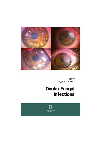 Ocular Fungal Infections