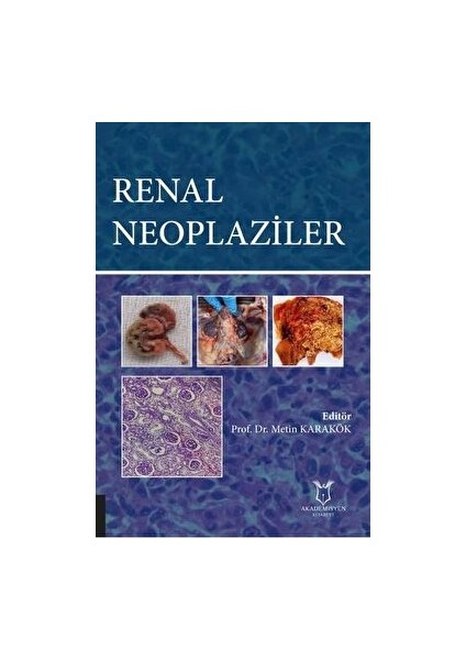Renal Neoplaziler