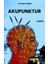 Akupunktur 1