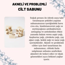 Akneli(sivilceli) Yağlı Cilt Sabunu %100 Doğal, Vegan Ve El Yapımı, 1 Adet Ve Ağırlığı 100±5 Gr.