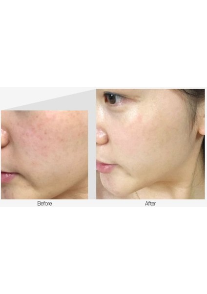 Yüz Esansı 50 ml