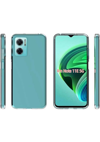 Xiaomi Redmi Note 11E Kılıf Şeffaf Ince Esnek Süper Silikon modelleri