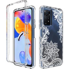 Lr Joyful Xiaomi Note 11 Pro Uyumlu Telefon Kabı - Çok Renkli  (Yurt Dışından)