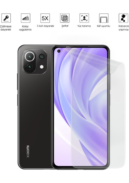 Kip GSM Xiaomi Mi 11 Lite Ekran Koruyucu Ekran Koruyucu Nano Temperli Esnek Koruma