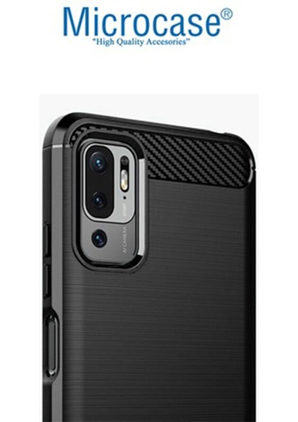 Xiaomi Redmi Note 11 Se - Redmi Note 10 5g Brushed Carbon Fiber Silikon Kılıf - Siyah