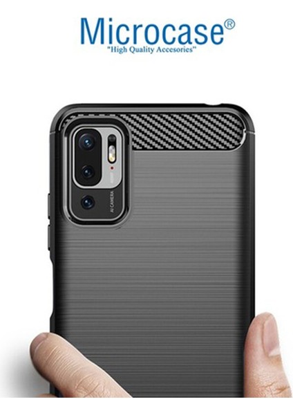 Xiaomi Redmi Note 11 Se - Redmi Note 10 5g Brushed Carbon Fiber Silikon Kılıf - Siyah