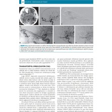 Kraniospinal Dural Avf’ler - Osman Kızılkılıç (Ciltli)