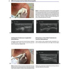 MRG ile Karşılaştırmalı Kas-İskelet Ultrasonografisi