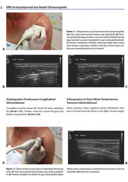 MRG ile Karşılaştırmalı Kas-İskelet Ultrasonografisi
