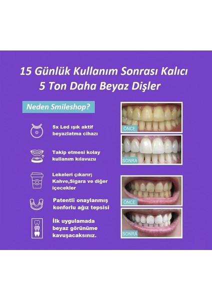 Diş Beyazlatma Seti fırsatları