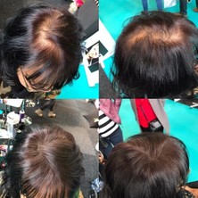 Organische 4 Kutu 200 Gram Hair Keratin Fibers Orta Kahve Topik