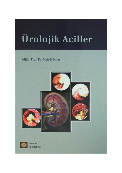 Ürolojik Aciller