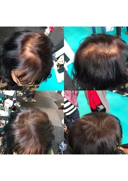 4 Kutu 200 Gram Hair Keratin Fibers Orta Kahve Topik