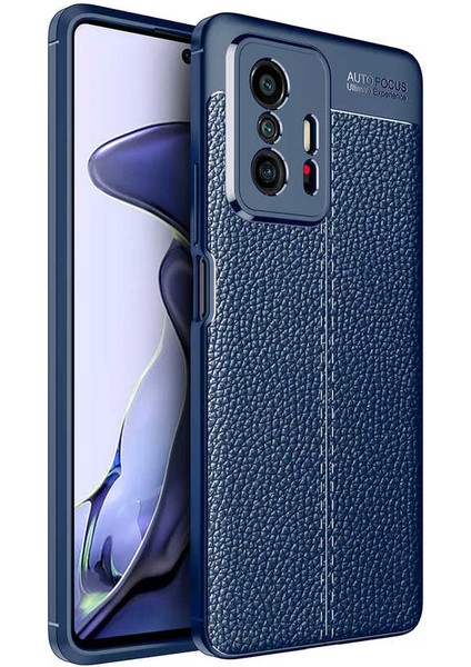 Xiaomi Mi 11T 5g Kılıf Rugan Armor Deri Görünümlü Niss Silikon Lacivert