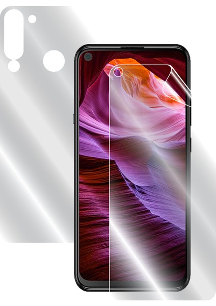 Casper Via X20 Tam Kaplama (Ekran ve Arka Koruma)
