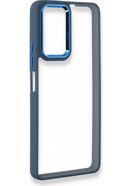 Xiaomi Redmi Note 10 Pro Kılıf A+++ Dora Silikon Kapak + Kablo Koruyucu