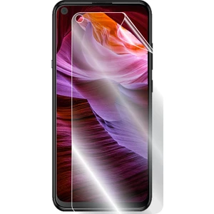 Ipg Casper Via X20 Görünmez Ekran Koruyucu