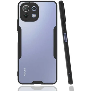 Xiaomi Mi 11 Lite Kılıf Renkli ve Koruyucu Silikon Hopypar