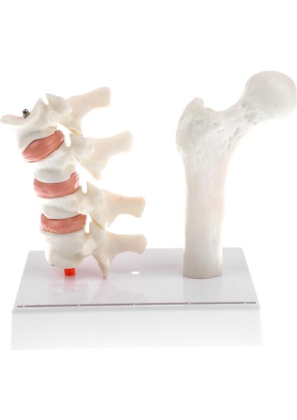 1: 1 Insan Osteoporoz Iskeleti Pathologica Modeli, Laboratuvar Gösteri Ekranı (Yurt Dışından)