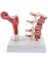 1: 1 Insan Osteoporoz Iskeleti Pathologica Modeli, Laboratuvar Gösteri Ekranı (Yurt Dışından) 2