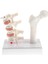 1: 1 Insan Osteoporoz Iskeleti Pathologica Modeli, Laboratuvar Gösteri Ekranı (Yurt Dışından) 3