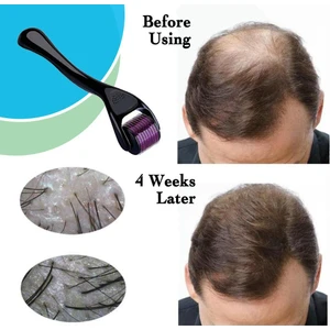 540 İğneli 0.5 - 1 mm Derma Roller Saç Cilt Yüz Tarak