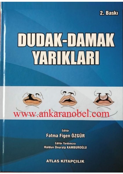 Dudak Damak Yarıkları - Fatma Figen Özgür