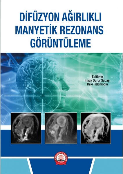Difüzyon Ağırlıklı Manyetik Rezonans Görüntüleme - Irmak Durur Subaşı