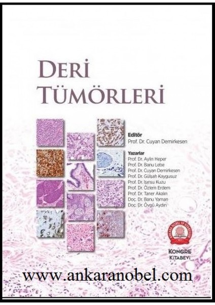 Deri Tümörleri - Cuyan Demirkesen