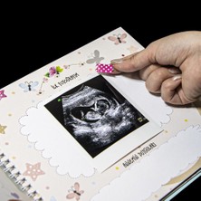 Nobbystar Anne & Bebek Hamilelik Anı Defteri - Sticker Hediyeli