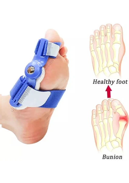 Baş Parmak Eğriliği Aparat Kemik Bunyon Gece  Takmak Için 1 Çift (Sağ ve Sol)