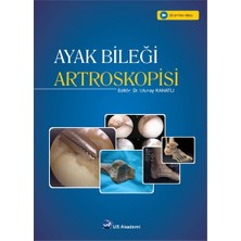 Ayak Bileği Artroskopisi