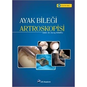 Ayak Bileği Artroskopisi