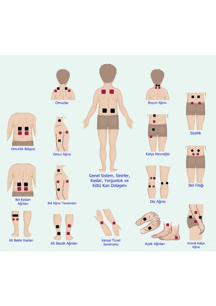 Medipal Tens Pedi - Tens Elektrot - 16 Adet 5x5 Çıtçıtlı modelleri