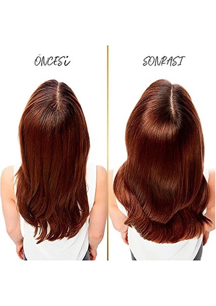 Şampuan 400 Ml Kepeğe Karşı Şampuan 3 Adet Pantene Kepeğe Karşı fırsatları