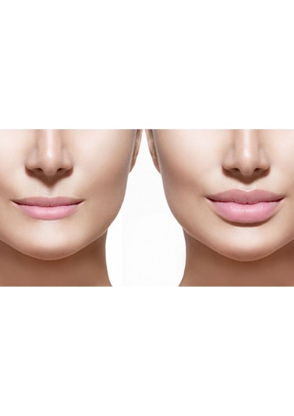 Plump Lips / Dolgun Dudaklar 6.5