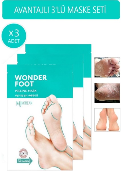 Ölü Deri ve Çatlaklar Için Soyulabilen Ayak Peeling Maskesi 50ML Wonder Foot Peeling Mask Wo
