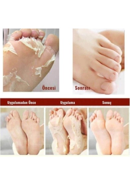 Professional Çorap Tipi Ayak Peeling Maskesi Ayak Maskesi- Foot Peeling Pack