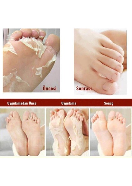 Foot Peeling Pack - Professıonal Çorap Tipi Ayak Peeling Maskesi 6'lı Set Ayak Maskesi