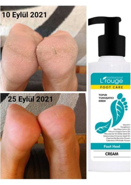 Çatlak Topuk Yumuşatıcı Krem Foot Heel Cream