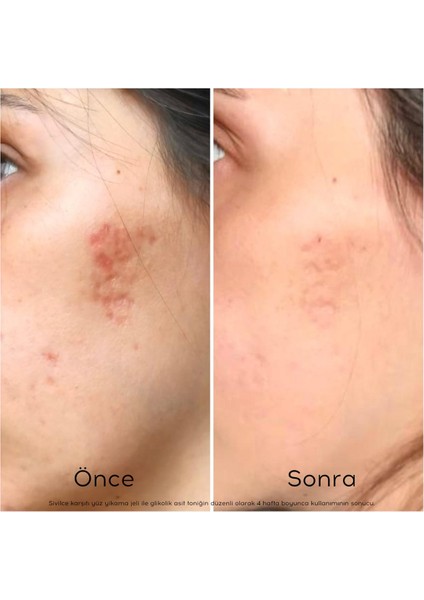 Glikolik Asit Peeling Tonik modelleri