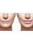 Plump Lips / Dolgun Dudaklar 6.5 4