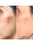 Glikolik Asit Peeling Tonik 3