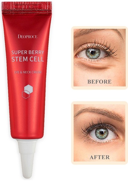 Adenozin Içeren Altı Koyu Görünümü & Boyun Kremi 10ML