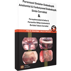 Paranazal Sinüsler Endoskopik Anatomisi Fonksiyonel Endoskopik Sinüs Cerrahisi