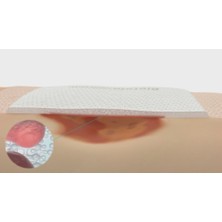 Coloplast 33435 Biatain Silikon Köpük Yara Örtüsü Yumuşak Yapışkanlı 10X10CM