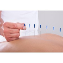 Maxi Akupunktur Iğnesi Kuru Iğne, Acupuncture Needle 0.30*50MM