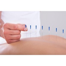 Maxi Akupunktur Iğnesi Kuru Iğne, Acupuncture Needle 0.30*60MM